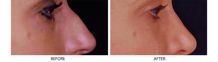 Las Vegas Strip Nonsurgical Job Aesthetic Haus